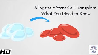 Allogeneic Stem Cell Transplant What You Need to Know [upl. by Oel]