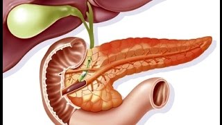 Acute Pancreatitis [upl. by Asserrac]