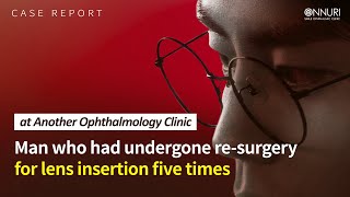 Case of Successfully Operating on a man Previously Deemed Inoperable at Another Ophthalmology Clinic [upl. by Woodward]