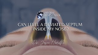 Can I feel a deviated septum inside my nose [upl. by Eitsyrhc]