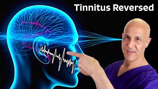 Tinnitus Reversed The Miracle of 1 Nutrient Dr Mandell [upl. by Bazar]