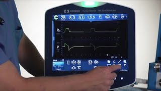 Puritan Bennett™ 980 Ventilator Basic Lesson Constant Access Icons [upl. by Ttehc]