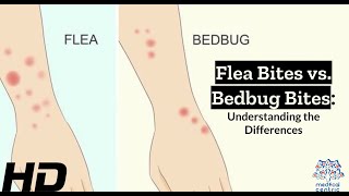 Bug Bite Showdown Identifying Flea vs Bedbug Bites [upl. by Eniger]