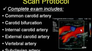 Cerebrovascular Ultrasound How to Do It Well [upl. by Barstow649]