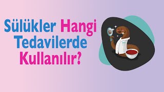 Sülük Tedavisi Nedir Sülükler Hangi Tedavilerde Kullanılır [upl. by Ydroj]