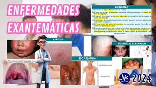 RM 24  Infectología Pediátrica Enfermedades Exantemáticas Estudios M Y C [upl. by Elvah]