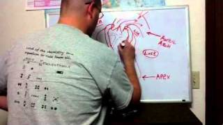 ECG Manifestations of ACS II [upl. by Kendre]