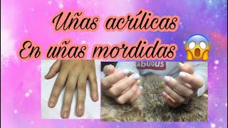 Uñas acrílicas en uñas mordidas  TRANSFORMACIÓN DE UÑAS mordidas [upl. by Siulesoj]