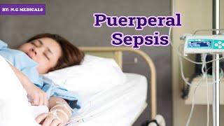 puerperal sepsis part 1 NGMedicals [upl. by Vasquez568]