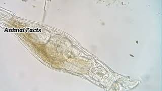 quotBdelloid Rotifer The Tiny Survivor That Defies Agingquot [upl. by Asselem688]