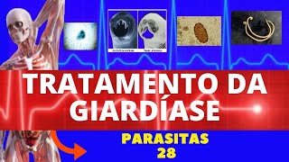 TRATAMENTO PARA GIARDÍASE GIARDIA LAMBLIA  COMO RESOLVER A GIARDÍASE  PARASITOLOGIAINFECTOLOGIA [upl. by Lovell]