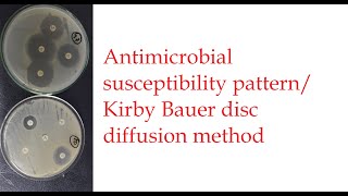 Practical Video Guide of Antibiotic Sensitivity Test  Kirby Bauer  Disc Diffusion Method [upl. by February877]