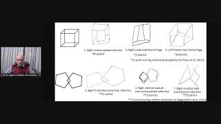 Constructional apraxia in brain jaundice in COVID time [upl. by Griffith854]