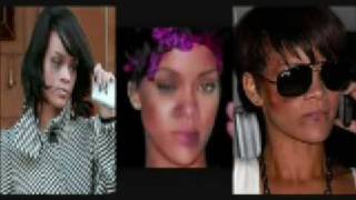 Rhianna Shocking Photos After Chris Brown Attack [upl. by Coheman]