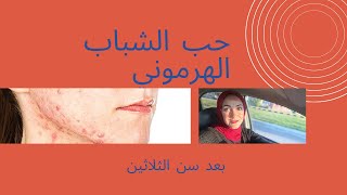 اهم علاج لحب الشباب الهرموني بعد سن الثلاثين معلومات مهمه جدا لكل البنات والسيدات Hormonal acne [upl. by Jezabel840]