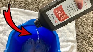 Put Hydrogen Peroxide on your FEET amp SEE WHAT HAPPENS 💥 this is cool and surprising [upl. by Bostow]