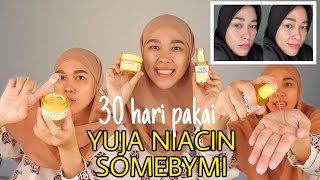 KINCLONG KESAT PAKE SOMEBYMI YUJA NIACIN [upl. by Sairtemed]