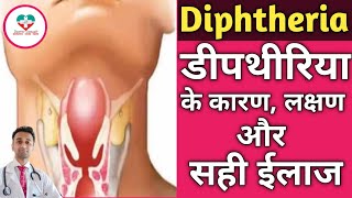 Diphtheria  डीपथेरिया किस वजह से होता है इसका ईलाज क्या है [upl. by Arlen805]