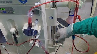 Air embolism during dialysis How to remove air during dialysis [upl. by Yerhcaz]