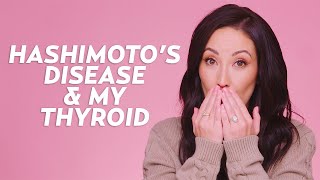 How My Hashimotos Disease Affects My Appearance Hypothyroid Symptoms  Skincare with Susan Yara [upl. by Hebbe546]