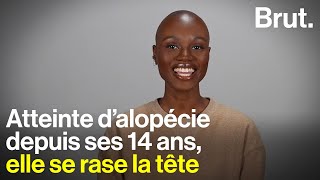 Atteinte dalopécie depuis ses 14 ans elle se rase la tête [upl. by Lavud958]