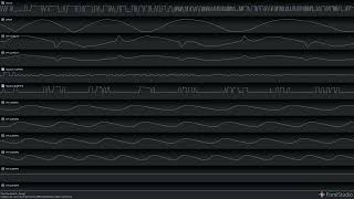 Fingers Inc  Can You Feel It 2A03 VRC7 amp EPSM Cover [upl. by Cort552]