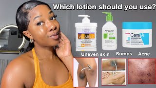 THE BEST BODY LOTIONS FOR UNEVEN SKIN  BODY ACNE  BUMPY SKIN  Fast working lotions‼️ [upl. by Noreh]