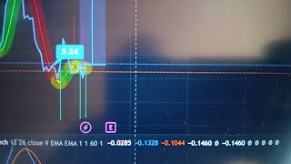 NIO INC STOCK COULD POP 36 PERCENT IN A FEW DAYS trading mostaccuratebuysellindicatortradingview [upl. by Lucrece]