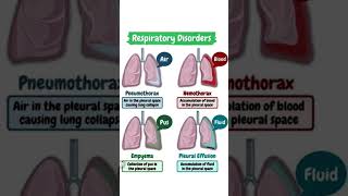 Pneumothorax vs Haemothorax vs Empyema Pleural Effusion  NORCETRRBnorcet [upl. by Alya403]