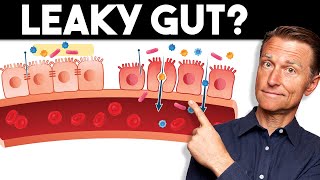 7 Signs of a Leaky Gut — Dr Berg [upl. by Acissev]