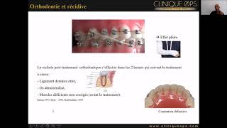 Partie 12  Le traitement Orthodontique nest pas efficace longtemps Préjugé ou vérité [upl. by Strait]