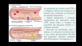 Laboratório de Habilidades  Patologia distúrbios hemodinâmicos  trombose e embolia  parte 01 [upl. by Zins512]