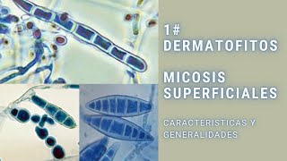 Micosis superficiales  1  Dermatofitos  Trichophyton  Epidermophyton  Microsporum [upl. by Japheth3]