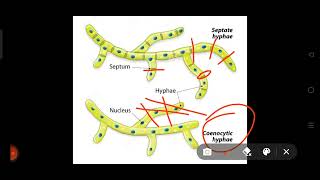 Septate hyphaeCoenocytic hyphaeneetbiologylifesxienceneet [upl. by Lasky14]