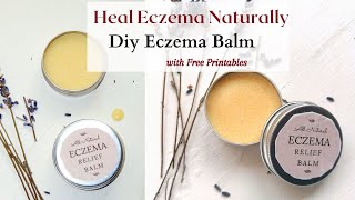 ECZEMA BALM RECIPE with Neem  How we treated Eczema Naturally with Diet Tips [upl. by Danelle]