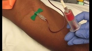 Phlebotomy Procedure Venipuncture with 21G Butterfly education phlebotomy tutorials [upl. by Yelena10]