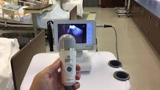 Caresono Bladder Scanner HowTo [upl. by Acinod]