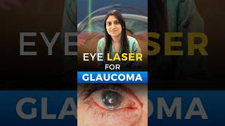 Eye Laser for Glaucoma [upl. by Publius772]