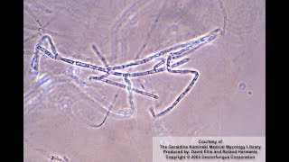 Microsporum ferrugineum identification [upl. by Drahcir216]