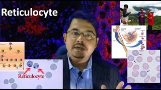 Reticulocyte Medschooldiscussion [upl. by Anazraf]