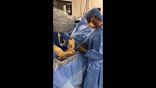 JONES FRACTURE SURGERY TECHNIQUE  Dr Sarang Desai [upl. by Evelin]