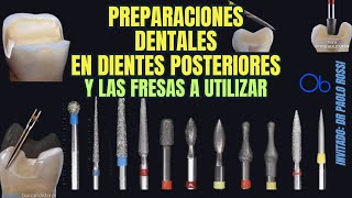 Preparaciones dentales en dientes posteriores y las fresas a utilizar 🦷 paso a paso [upl. by Whiting290]