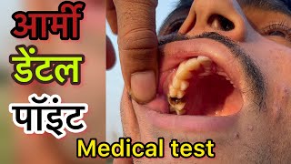 Army Dental Medical test Full Details video  Army Airforce amp Navy Dental test army armylover [upl. by Easton483]