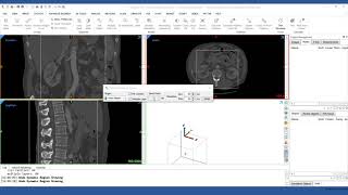 How to Use Dynamic RegionGrowing in Mimics  Mimics Innovation Suite  Materialise Medical [upl. by Somerset]