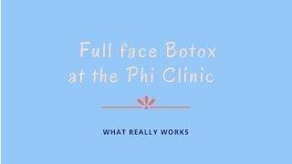 Having full face Botox at the Phi Clinic  Alice HartDavis [upl. by Nnovahs785]