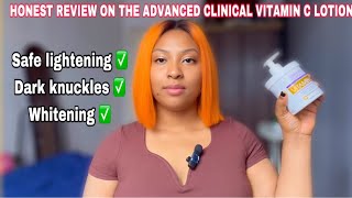 HONEST REVIEW ON THE ADVANCED CLINICALS VITAMIN C LOTION  WHITENING AND LIGHTENING SKIN [upl. by Sirenay]