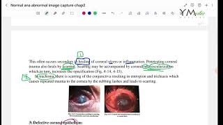 Image Capture Diseases OPH [upl. by Notaes326]