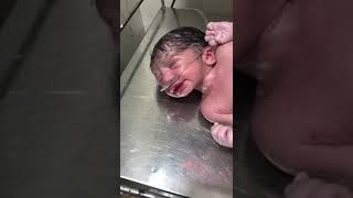 New Born Girl Baby After Vernix Cleaning Here [upl. by Sivatco]