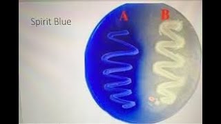 Lipolytic bacteria and spirit blue agar البكتيريا المحللة للدهون [upl. by Shelton]