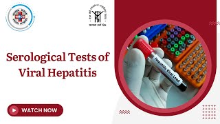 Serological Tests of Viral Hepatitis [upl. by Helli]